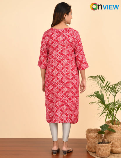 ONVIEW | 1520 | FOIL PRINT